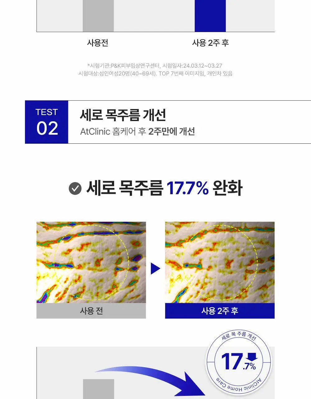 [목주름 개선] 도미나스 앳클리닉 레티놀 1600 넥 샷 목주름 세럼 30ml 상세페이지 12